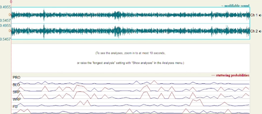 stutter-detection